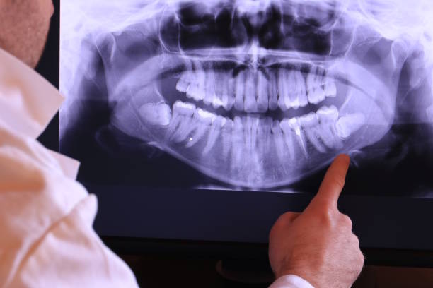 Best Orthodontic Emergency Dentist in Lanse, MI