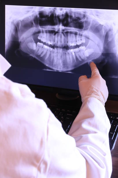Best Holiday Emergency Dentist in Lanse, MI