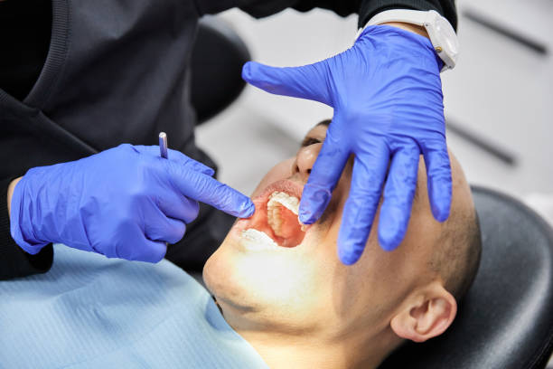 Best Emergency Dental Extractions in Lanse, MI